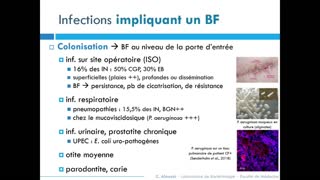 Vid Oth Que De L Ul Replay Dupias Biofilm Et Ias