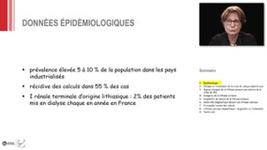 ECN 262 - Lithiase urinaire