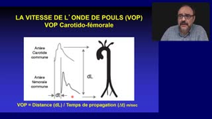 DES Geriatrie - 3ème partie - Vieillissement Cardio-Vasculaire  A. Benetos