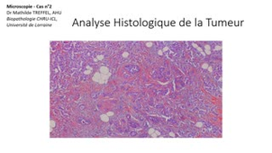 UE1 FGSM2 TP - microscopie cas n°2  Dr Treffel