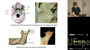 Spé tête et cou Strazielle Catherine 20/03/2025 (pt2) pass,Las2 et Las3