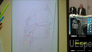 Spé Tête et cou Pr Braun Marc 27/03/2026 (Pt4) LAS 2 et 3