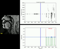 IRM dynamique du conduit vocal pour une série de phrases en amharique