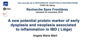 A new potential protein marker of early dysplasia and neoplasia associated to inflammation in IBD