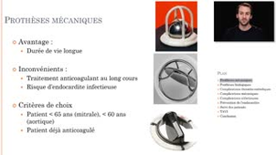 ECN 150 - Surveillance des porteurs de valve et prothèses vasculaires