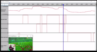 Rehabeelitation : Data acquisition during serious game