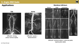 4.4c Angiographie par injection de Gadolinium.mp4