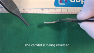 Retrournement d'artère