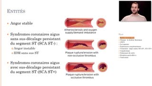 ECN 334 - Syndromes coronaires aigus - p1