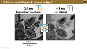 4.2b Artéfacts Déplacement Chimique.mp4