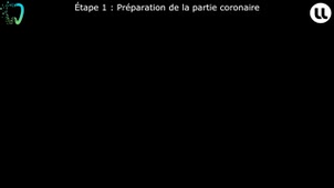 Restauration corono-radiculaire directe à l'aide d'un matériau inséré en phase plastique