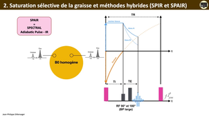 4.3b Suppression de la graisse- FAT SAT SPIR SPAIR.mp4