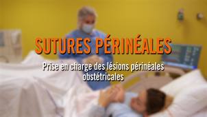 Sutures périnéales : Prise en charge des lésions périnéales obstétricales