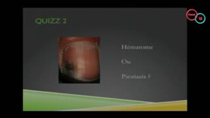 22 Onychopathie et rhumatologie (Paul Ornetti)