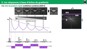 3.4c Séquences à base d'echos de gradients.mp4