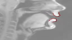 Lip tracking in a MRI film