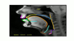 Automatic tracking speech articulators in rt-MRI films (Vinicius Ribeiro PhD)