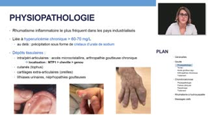 ECN 194  Arthropathie microcristalline