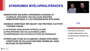 ECN 314 - Sydromes myéloprolifératifs (SMP)