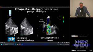 UE6 Marie Pierre-Yves 22/04/2026