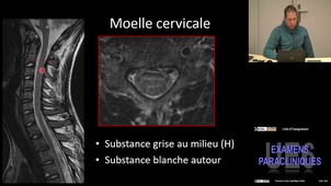 UE6 Gory Benjamin 07/04/2026 (Pt2)