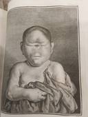 Bébé cyclope - Monstres ! Une histoire de la tératologie