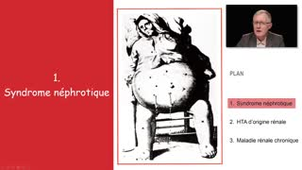 ECN 256 - Protéinurie - Syndrome néphrotique