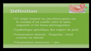11 Fractures de contrainte pied et chevilles (Pr I. Chary-Valckenaere)