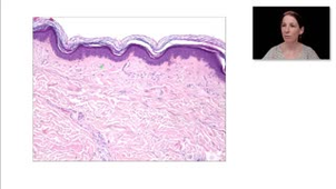 ECN 110 - Dermatoses bulleuses auto-immunes