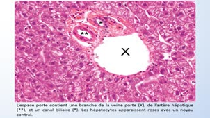 UE13 App. Dig. FGSM2 - Ana Path - 1. Path. inflammatoire B - Foie, VB et pancréas - G Gauchotte 2020