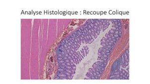 UE1 FGSM2 TP - microscopie cas n°1  Dr Campoli