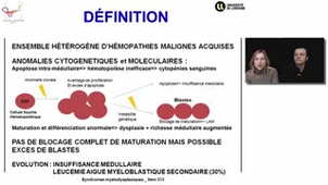 ECN 313 - Syndromes myélodysplasiques (SMD)