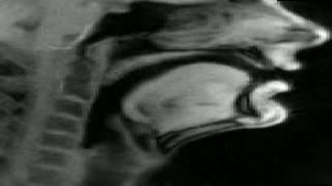 MRI film 8066_0013