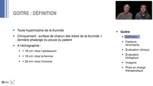 ECN 239 - Goitre,Nodules-cancers thyroidien - L. Demarquet, M. Klein
