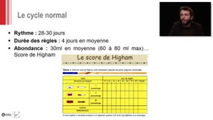 ECN 034 - Trouble du cycle menstruel
