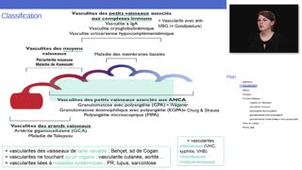 ECN 189 - Vascularites systémiques