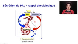 ECN 242bis partie 1 - Découverte de l'adénome hypophysaire devant un syndrome d'hypersécrétion