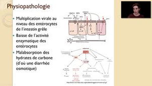ECN 172 - Diarrhées infectieuses de l'adulte et de l'enfant - Virologie