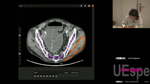 P-Bassin Pr Perez Manuela 20/02/2026 (Pt3)