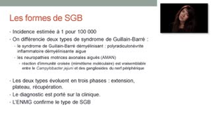 ECN 095 - Syndrome de Guillain-Barré (SGB)