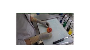 UE1 FGSM2 TP - macroscopie cas n°2  Dr Treffel