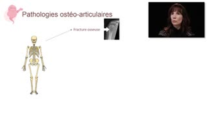 Exemples d'utilisations des cellules souches en ingénierie tissulaire - Chapitre 3 - partie 4