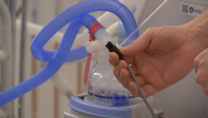 Présentation d'un patient avec une ventilation mécanique